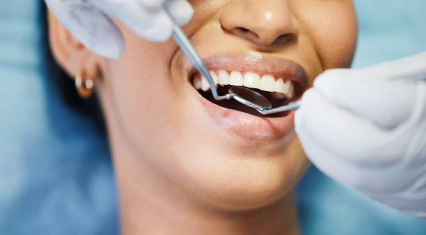 Best Emergency Dental Surgery in Brandermill, VA
