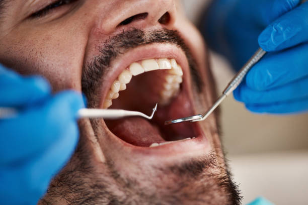 Best Emergency Treatment for Toothache in Brandermill, VA